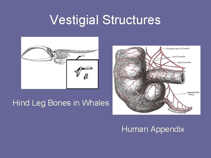 Vestigial Structures Hind Leg Bones in Whales Human Appendix 