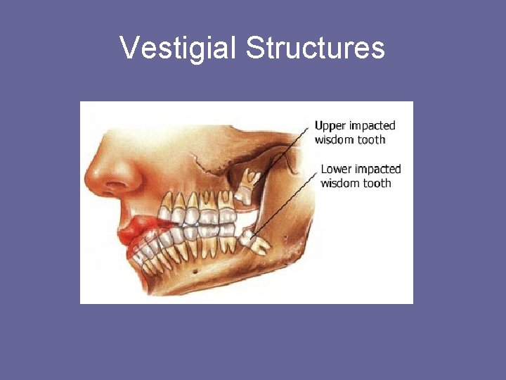 Vestigial Structures 