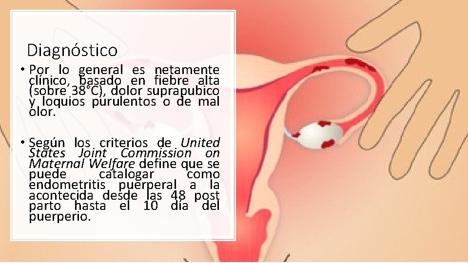 Diagnóstico • Por lo general es netamente clínico, basado en fiebre alta (sobre 38°C),