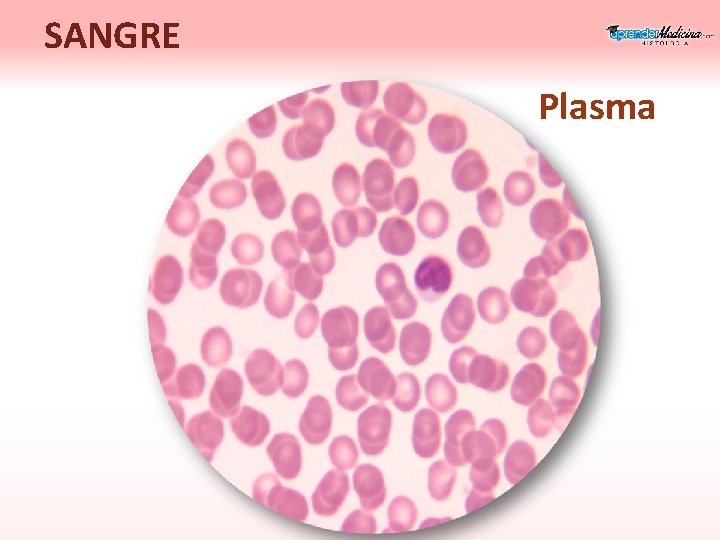 SANGRE Plasma 
