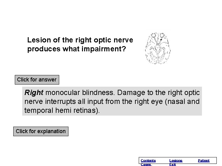 Lesion of the right optic nerve produces what impairment? Click for answer Right monocular Lesion of the right optic nerve produces what impairment? Click for answer Right monocular