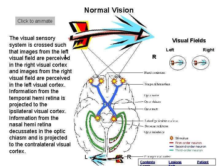 Normal Vision Click to animate The visual sensory system is crossed such that images Normal Vision Click to animate The visual sensory system is crossed such that images