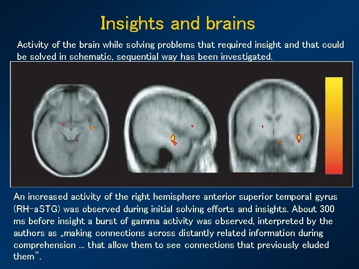 Insights and brains Activity of the brain while solving problems that required insight and