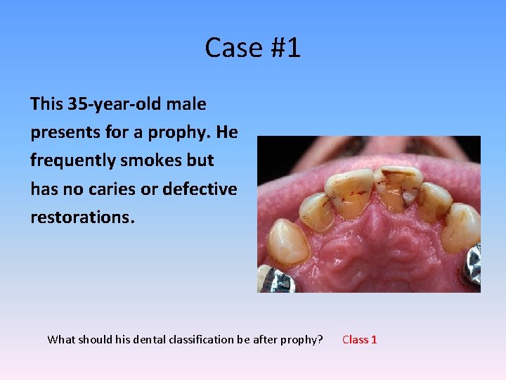 Case #1 This 35 -year-old male presents for a prophy. He frequently smokes but