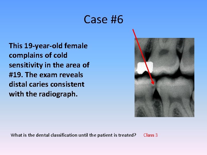 Case #6 This 19 -year-old female complains of cold sensitivity in the area of