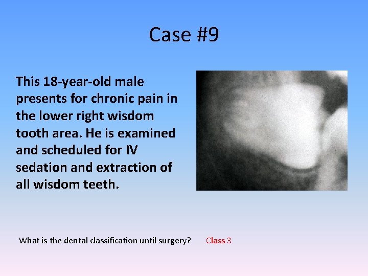 Case #9 This 18 -year-old male presents for chronic pain in the lower right