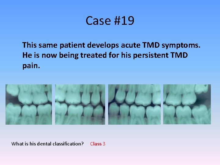 Case #19 This same patient develops acute TMD symptoms. He is now being treated