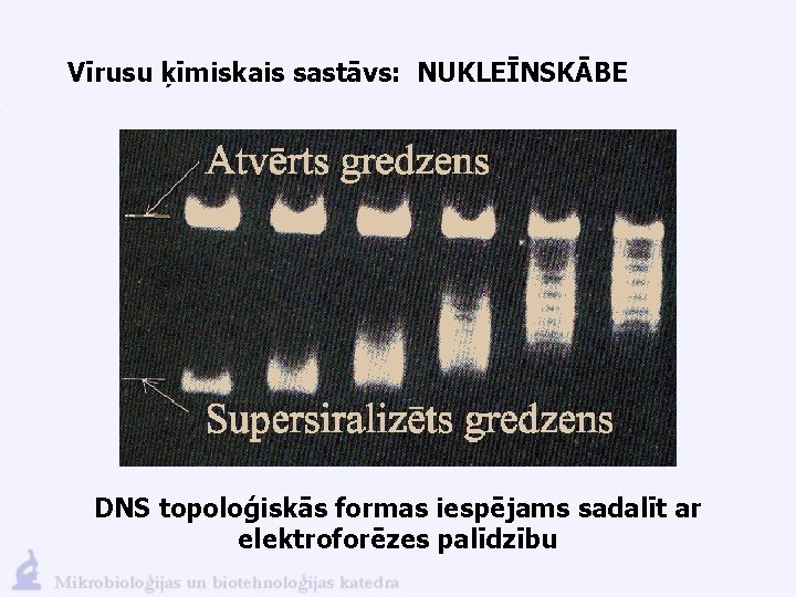 Vīrusu ķīmiskais sastāvs: NUKLEĪNSKĀBE DNS topoloģiskās formas iespējams sadalīt ar elektroforēzes palīdzību 