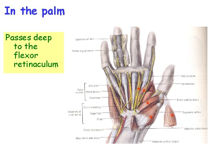 In the palm Passes deep to the flexor retinaculum ** * 
