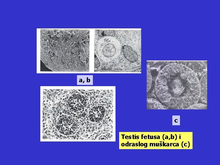 a, b c Testis fetusa (a, b) i odraslog muškarca (c) 