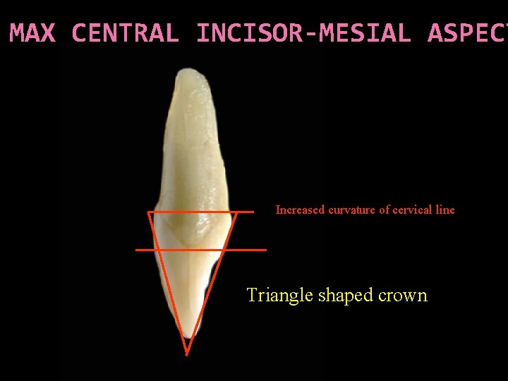 MAX CENTRAL INCISOR-MESIAL ASPECT Increased curvature of cervical line Triangle shaped crown 