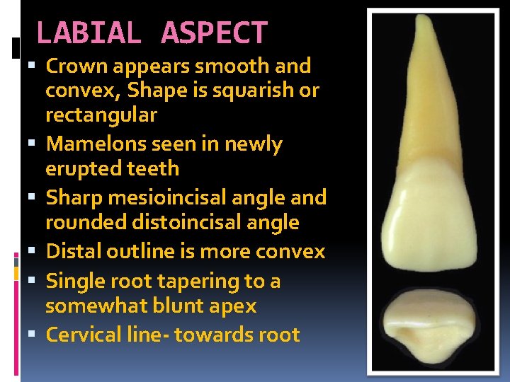 LABIAL ASPECT Crown appears smooth and convex, Shape is squarish or rectangular Mamelons seen