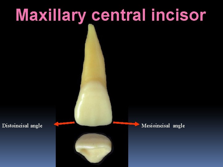 Maxillary central incisor Distoincisal angle Mesioincisal angle 