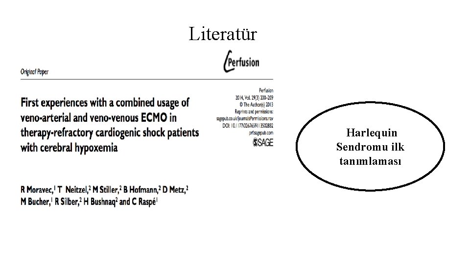 Literatür Harlequin Sendromu ilk tanımlaması Literatür Harlequin Sendromu ilk tanımlaması