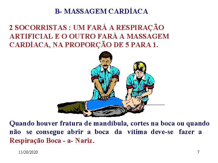 B- MASSAGEM CARDÍACA 2 SOCORRISTAS : UM FARÁ A RESPIRAÇÃO ARTIFICIAL E O OUTRO