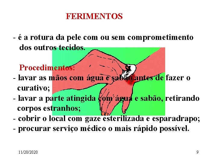 FERIMENTOS - é a rotura da pele com ou sem comprometimento dos outros tecidos.