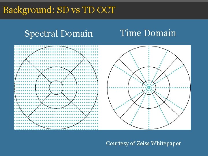 Background: SD vs TD OCT Spectral Domain Time Domain Courtesy of Zeiss Whitepaper Background: SD vs TD OCT Spectral Domain Time Domain Courtesy of Zeiss Whitepaper