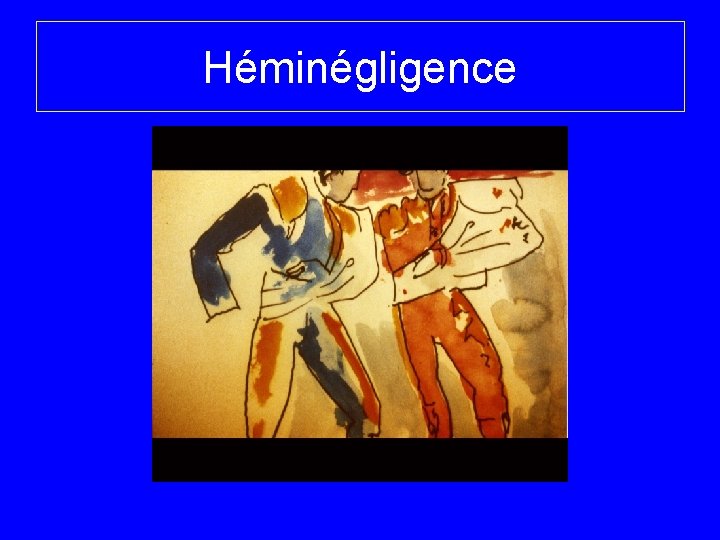Héminégligence 