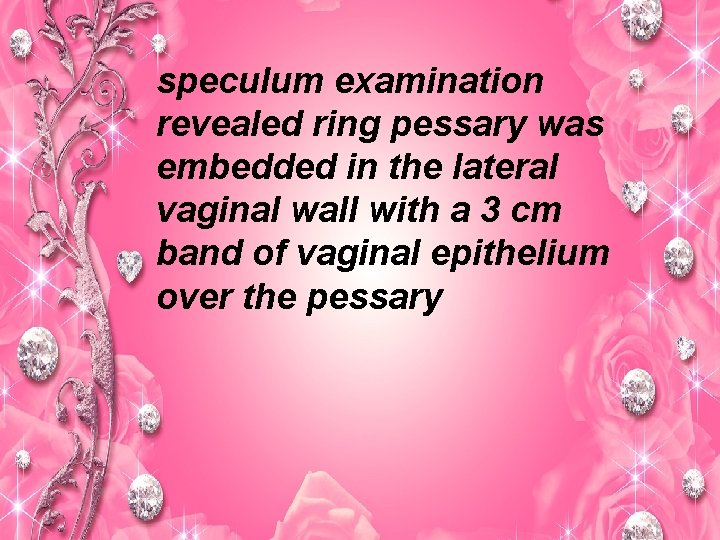 speculum examination revealed ring pessary was embedded in the lateral vaginal wall with a