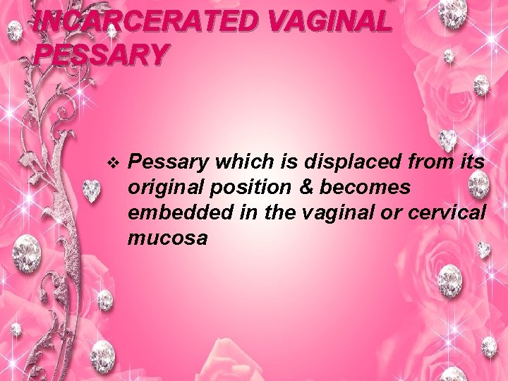 INCARCERATED VAGINAL PESSARY v Pessary which is displaced from its original position & becomes