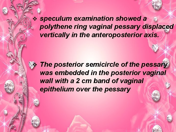 v speculum examination showed a polythene ring vaginal pessary displaced vertically in the anteroposterior