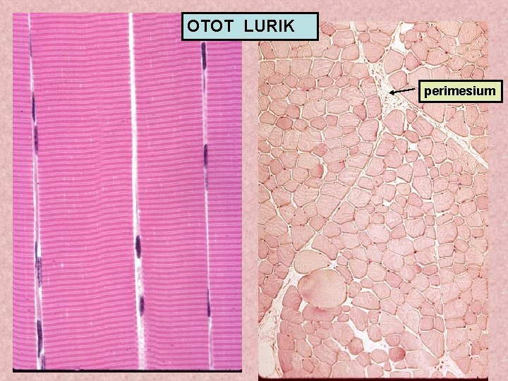 OTOT LURIK perimesium 