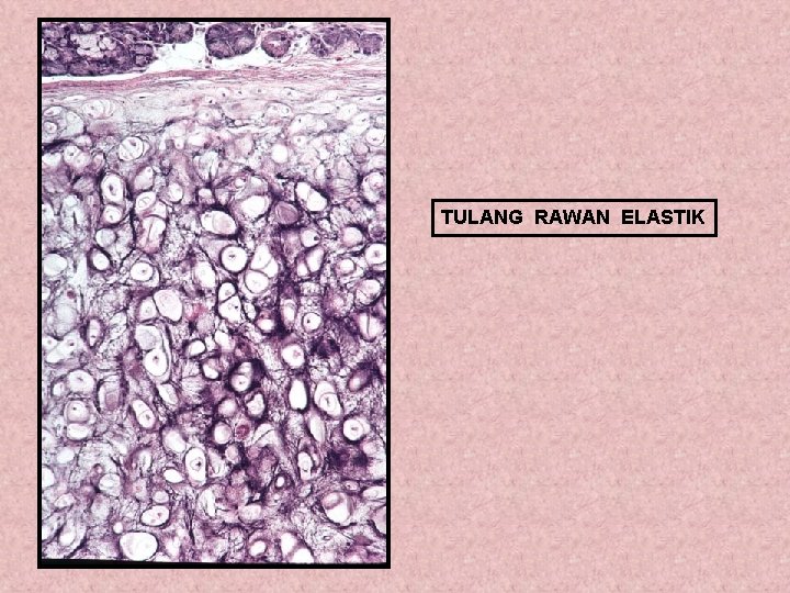 TULANG RAWAN ELASTIK 