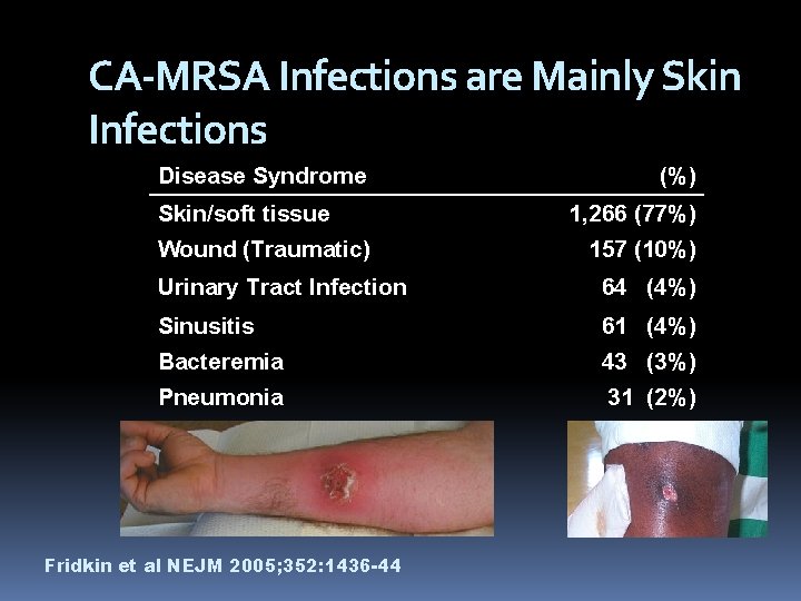 CA-MRSA Infections are Mainly Skin Infections Disease Syndrome Skin/soft tissue Wound (Traumatic) (%) 1,