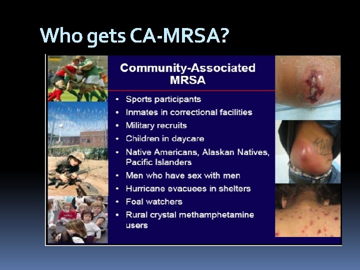 Who gets CA-MRSA? 