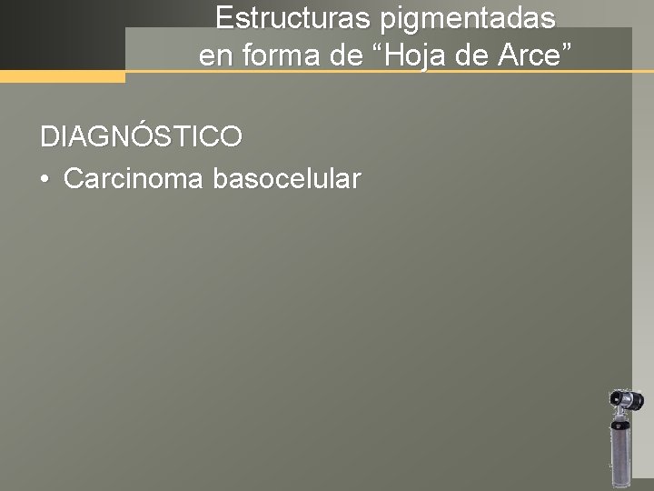 Estructuras pigmentadas en forma de “Hoja de Arce” DIAGNÓSTICO • Carcinoma basocelular 