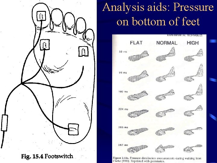 Analysis aids: Pressure on bottom of feet 
