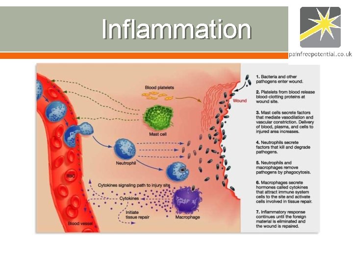 Inflammation Inflammation