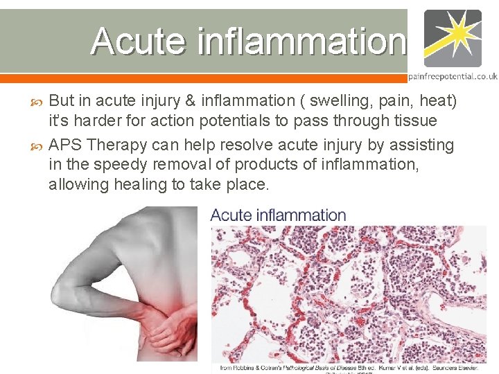 Acute inflammation But in acute injury & inflammation ( swelling, pain, heat) it’s harder Acute inflammation But in acute injury & inflammation ( swelling, pain, heat) it’s harder
