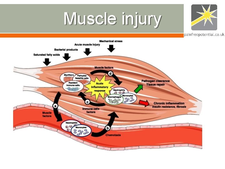 Muscle injury Muscle injury