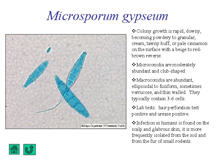 Microsporum gypseum Colony growth is rapid, downy, becoming powdery to granular, cream, tawny-buff, or