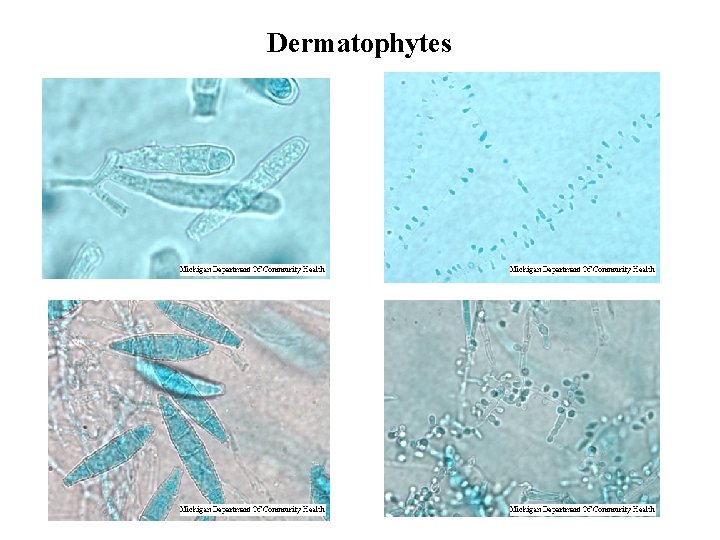 Dermatophytes 