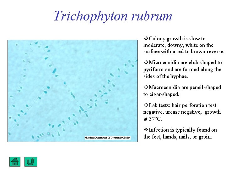 Trichophyton rubrum Colony growth is slow to moderate, downy, white on the surface with
