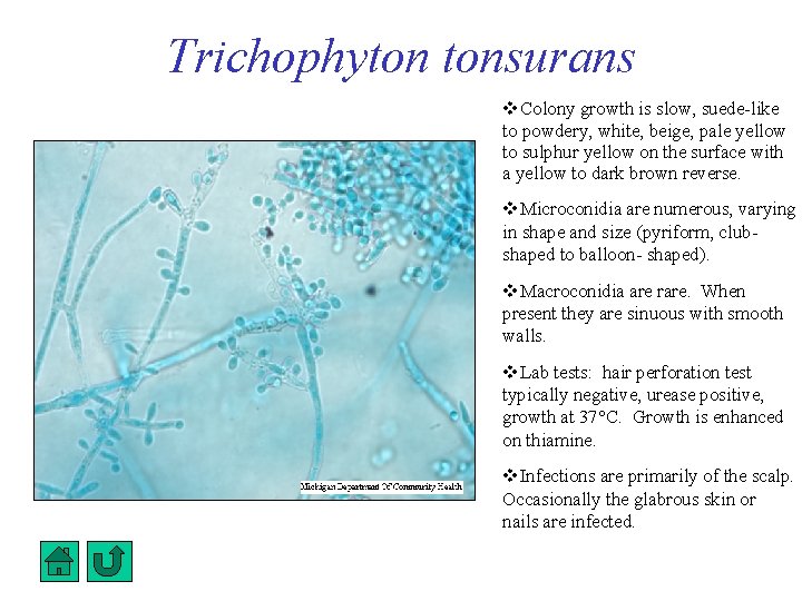 Trichophyton tonsurans Colony growth is slow, suede-like to powdery, white, beige, pale yellow to