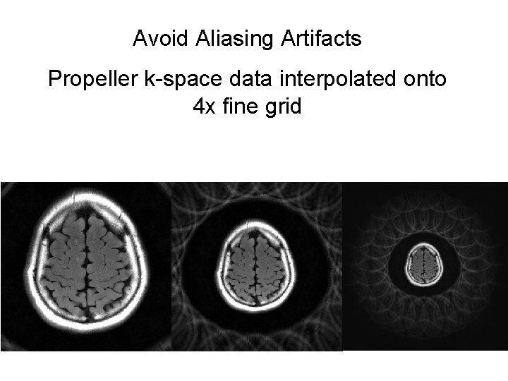 Avoid Aliasing Artifacts Propeller k-space data interpolated onto 4 x fine grid 