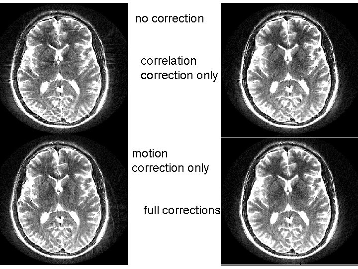 no correction correlation correction only motion correction only full corrections 