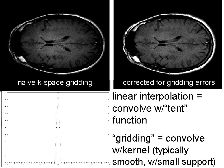  high-order interp overshoots naive k-space gridding corrected for gridding errors low-order interp smooths