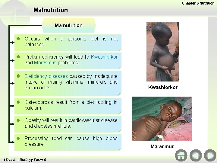 Chapter 6 Nutrition Malnutrition Occurs when a person’s diet is not balanced. Protein deficiency