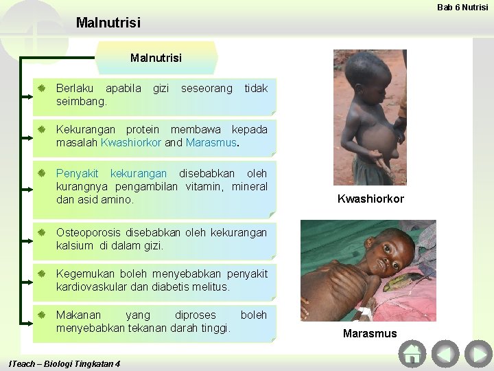 Bab 6 Nutrisi Malnutrisi Berlaku apabila seimbang. gizi seseorang tidak Kekurangan protein membawa kepada