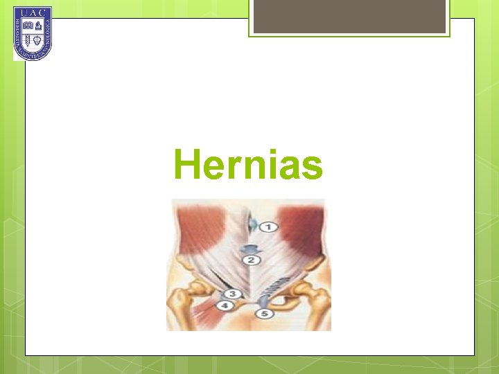 Hernias 