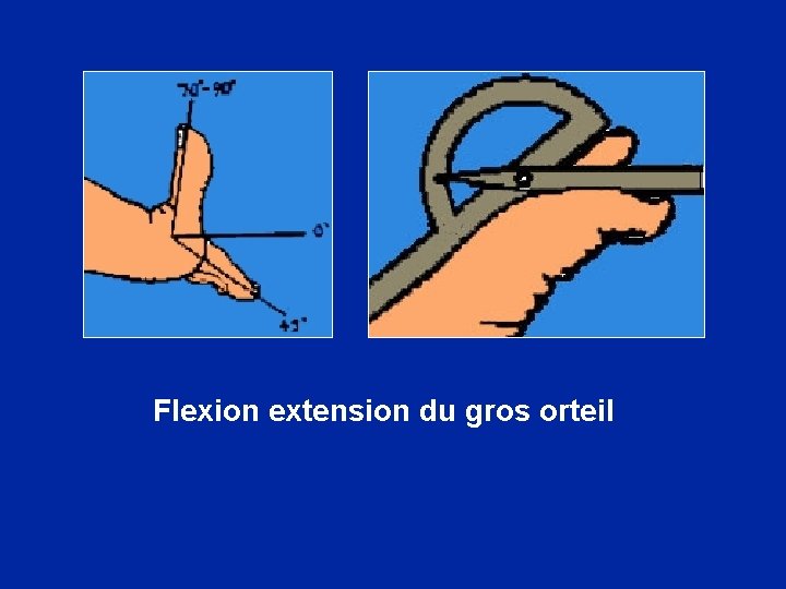 Flexion extension du gros orteil 