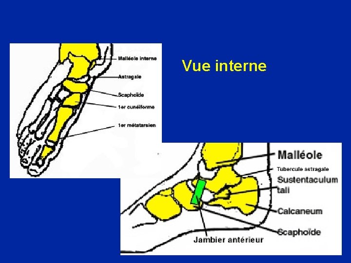 Vue interne 
