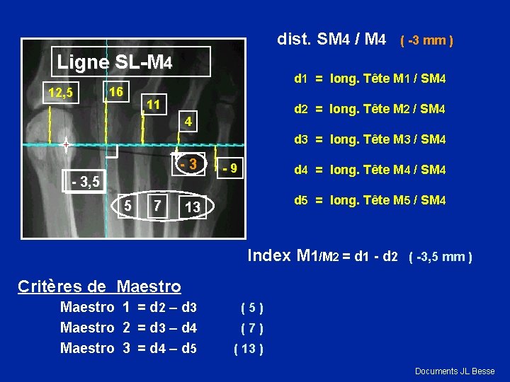 dist. SM 4 / M 4 ( -3 mm ) Ligne SL-M 4 12,