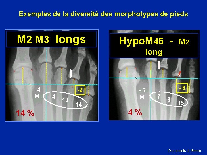 Exemples de la diversité des morphotypes de pieds M 2 M 3 longs Hypo.