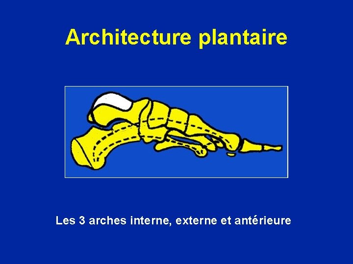 Architecture plantaire Les 3 arches interne, externe et antérieure 