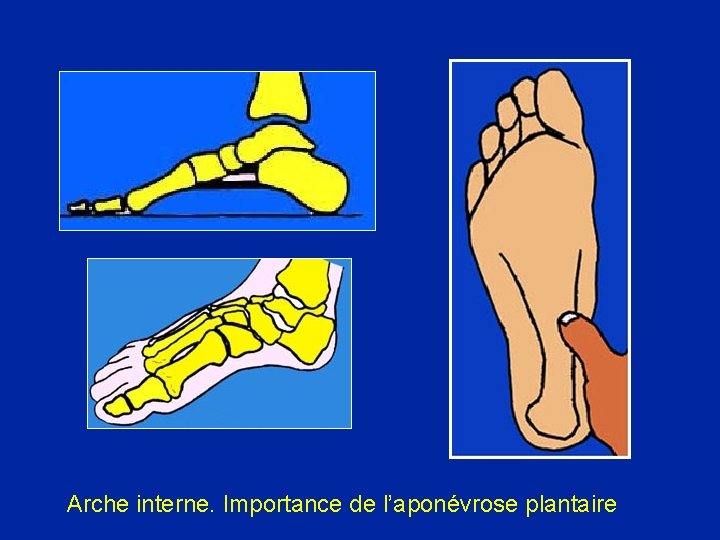 Arche interne. Importance de l’aponévrose plantaire 